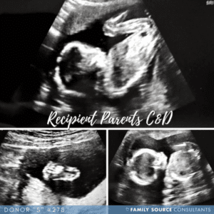 egg donor updates! august 2017