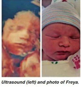 new dad bill guest beat biological clock with help of surrogate